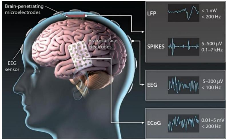 【四海读报】20260324—脑机接口深度报告：未来产业制高点竞速，多场景需求打开成长空间-四海清单