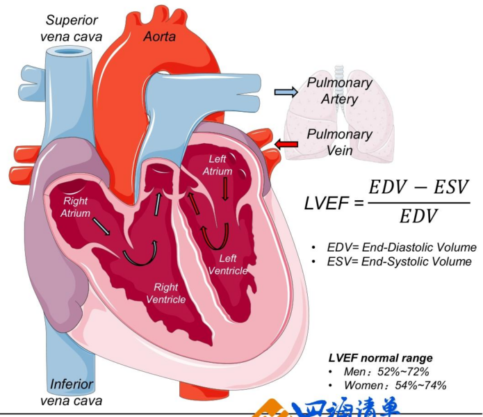 【四海读报】20260420—创新药盘点系列报告（26）：四大支柱后，HFrEF心衰领域还有哪些升级空间？-四海清单